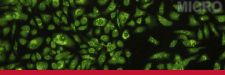 NATURE: Interactions between cancer stem cells and their niche govern metastatic colonization